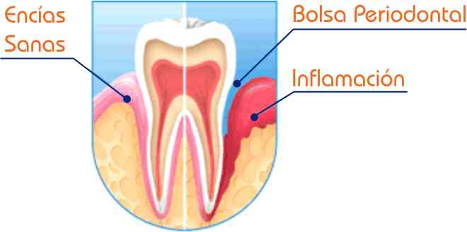 PERIODONCIA 1