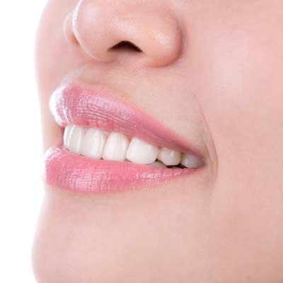 Blanqueamiento dental