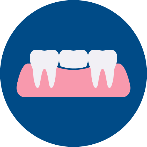 Prótesis dental