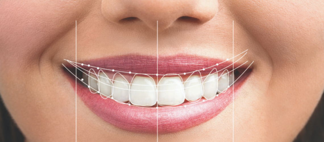 Descubre la Importancia de una Sonrisa Deslumbrante con Nuestros Tratamientos de EstÃ©tica DentalÂ 